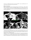 Các lĩnh vực mở rộng của kỹ thuật mổ nội soi mũi xoang