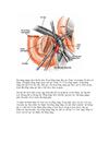Phẫu thuật cắt khối tá tuỵ bảo tồn môn vị