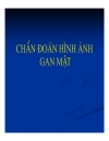 Chẩn đoán hình ảnh gan mật