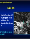 U đặc tủy u nang tụy 1