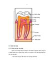 Nhận xét lâm sàng XQ nhóm bệnh nhân viêm tuỷ có hồi phục được chụp tuỷ gián tiếp bằng Dycal và Eugenate