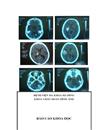 Nghiên cứu đặc điểm hình ảnh và giá trị của chụp cắt lớp vi tính trong chẩn đoán xuất huyết não do tai biến mạch máu não