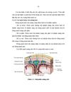 Nghiên cứu đặc điểm lâm sàng và hình ảnh học của bệnh nhân xuất huyết dưới nhện do vỡ phình động mạch thông trước tại khoa thần kinh bệnh viện Bạch Mai