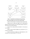 Nhận xét đặc điểm lâm sàng Xquang và đánh giá kết quả điều trị nội nha các răng viêm quanh cuống mạn tính với băng thuốc hydroxit canxi