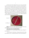 Đặc điểm sinh học phân tử của Haemophilus influenzae typ b Hib phân lập từ bệnh nhi viêm màng não mủ dưới 5 tuổi và trẻ khỏe mạnh tại Nhà trẻ Mẫu giáo