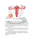 Nghiên cứu chẩn đoán và xử trí polyp buồng tử cung tại Bệnh viện phụ sản trung ương năm 2010