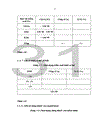 Tỷ lệ rối loạn cương dương ở bệnh nhân đái tháo đường tại bệnh viện Bạch Mai