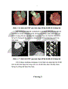 Khả năng hiện ảnh các đoạn các nhánh của ĐMV trên hình ảnh chụp CLVT 64 lớp