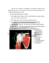 Phương pháp tiêm corticoid dưới hướng dẫn của siêu âm trong điều trị viêm quanh khớp vai thể đau khớp vai đơn thuần và thể đau vai cấp