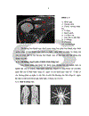 Phương pháp tiêm corticoid dưới hướng dẫn của siêu âm trong điều trị viêm quanh khớp vai thể đau khớp vai đơn thuần và thể đau vai cấp