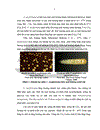 Nghiên cứu đặc điểm lâm sàng cận lâm sàng của viêm màng não do nấm Cryptococcus neoformans ở bệnh nhân HIV AIDS