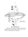 Đánh giá hiệu quả của phương pháp tiêm corticoid dưới hướng dẫn của siêu âm trong điều trị viêm quanh khớp vai