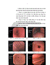 Nghiên cứu đặc điểm tổn thương và kết quả điều trị polyp dạ dày bằng nội soi ống mềm tại Bệnh viện Hữu nghị Việt Đức