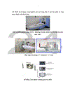 Nghiên cứu hiệu quả điều trị u thân não bằng phương pháp xạ phẫu dao gamma quay Rotating Gamma Knife