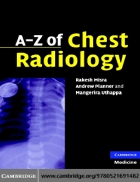 A Z of Chest Radiology