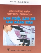 Các phương pháp phát hiện