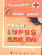 Chuan doan va phong tri benh Lupus ban do