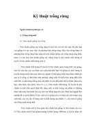 Kỹ thuật trồng rừng