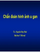 Chẩn đoán hình ảnh u gan