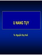 U đặc tủy u nang tụy 1